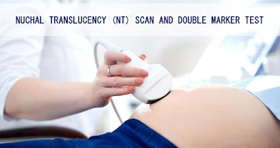 Nuchal Translucency (NT) Scan and Double Marker Test
